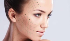 3D Face Lifting